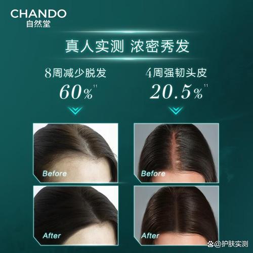 头皮精华哪个牌子效果比较好,选择适合你的护理方案